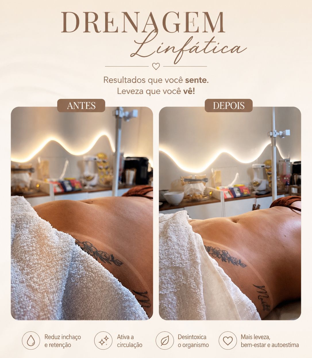 Antes e Depois Drenagem Linfática - Larissa Souza Estética